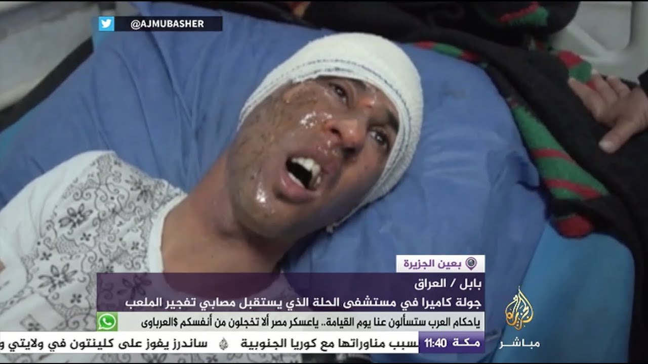 جولة في مستشفى الحلة الذي يستقبل مصابي تفجير الملعب بالعراق