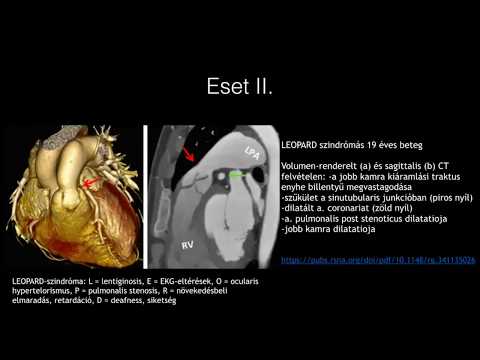 Videó: Anastomosis I - Orvosi Szakkifejezések Szótára