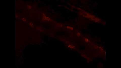 Intravital Microscopy - Brain