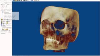 Export 3D volume from Planmeca® Romexis to Dolphin