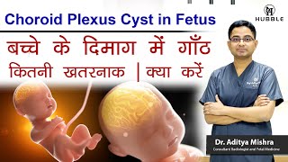 Choroid plexus cyst in fetus - बच्चे के दिमाग में गाँठ कितनी खतरनाक।क्या करें screenshot 3