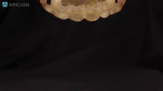 Surgical guide for dental implants