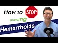 How to stop your hemorrhoids from growing