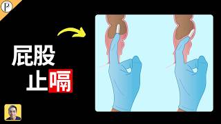 瘋狂打嗝竟然可以用屁股治好? 科學解析直腸按摩法(rectal massage)