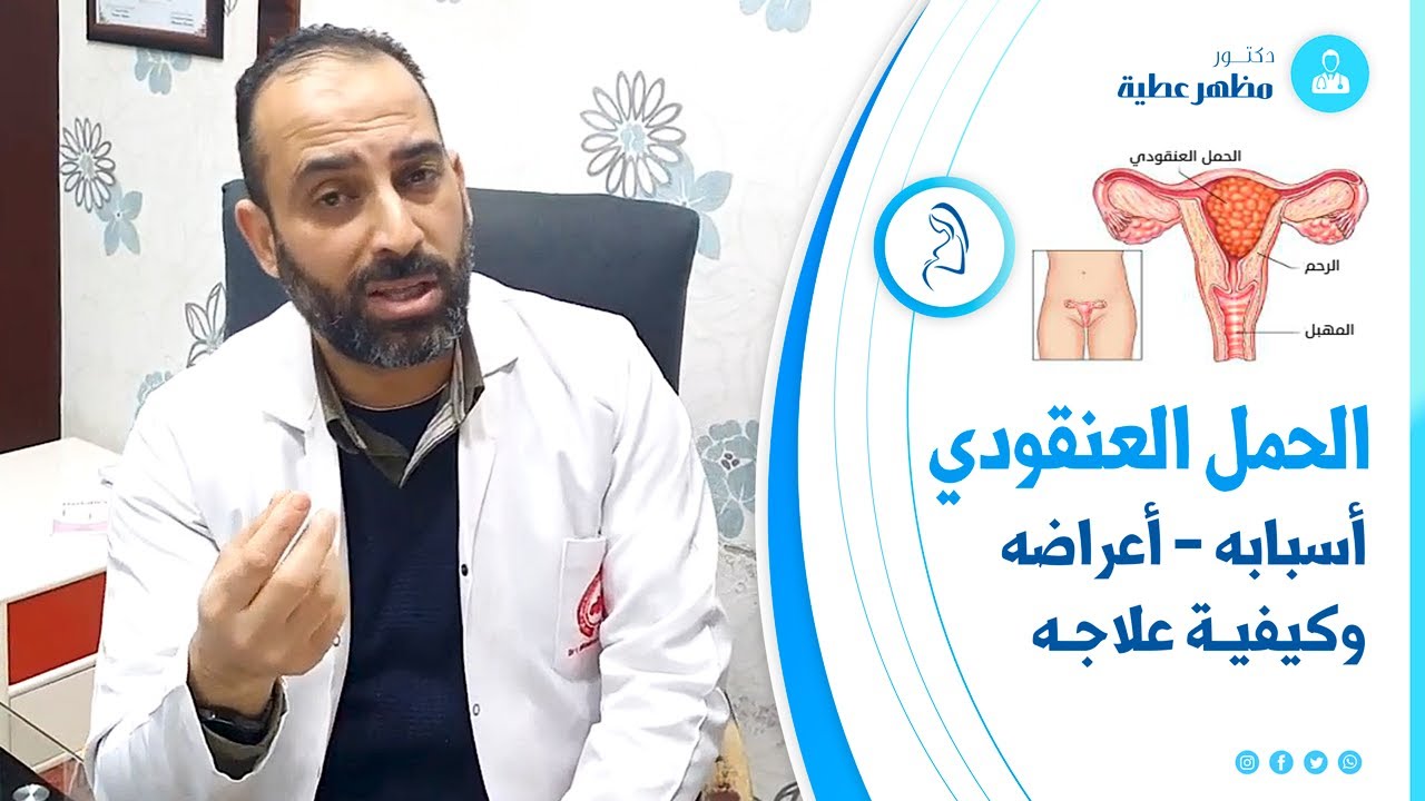 تعرفي على الحمل العنقودي؛ أسبابه - أعراضه وكيفيـة علاجـه - الجزء الثاني