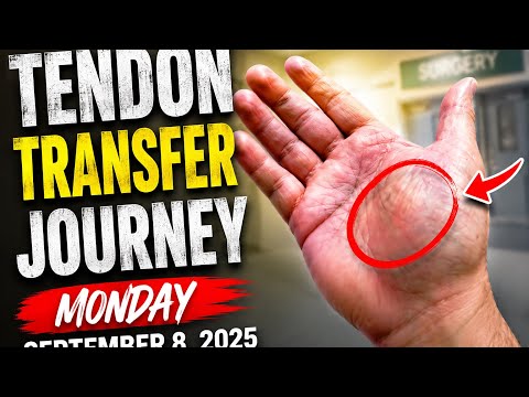 Tendon Transfer Journey Monday September 8, 2025
