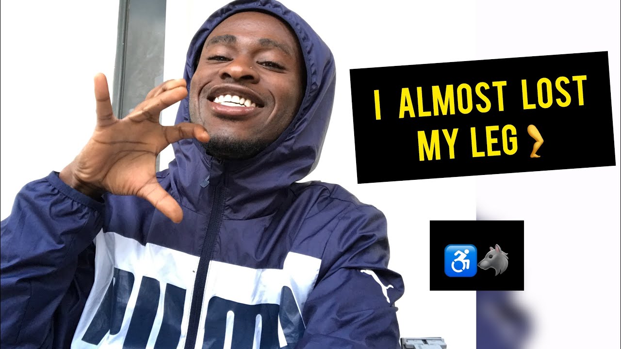 I almost lost my Leg 🦵😭| STORYTIME - YouTube