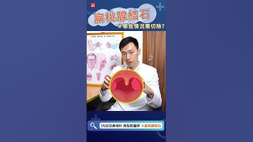 我的扁桃腺需要切除嗎？暖心醫師告訴你！#扁桃腺 #扁桃腺結石 #扁桃腺炎 #扁桃腺腫大 #扁桃腺切除 #耳鼻喉頭頸部 #光田醫院 #黃聖凱醫師