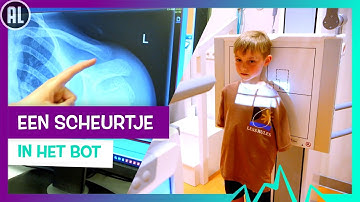 SLEUTELBEEN GEBROKEN 🦴🩺 | TOPDOKS SPOEDEISENDE HULP