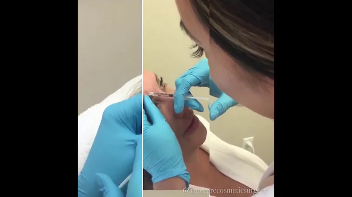 BOTOX INJECTIONS | Get Smoother skin in 2 weeks