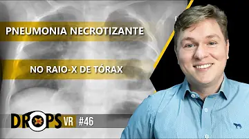 O que é uma pneumonia necrotizante?