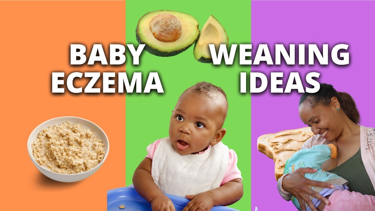 Meal Ideas for weaning your Baby How to avoid Eczema flare ups YouTube