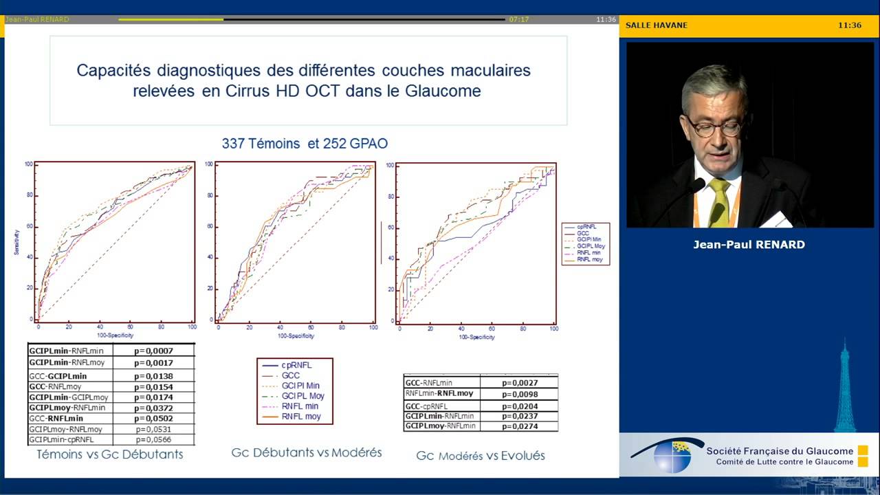 OCT et glaucome - Quel OCT pour la RNFL et/ou le complexe ganglionnaire maculaire (Jean-Paul Renard)