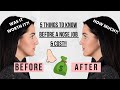 5 THINGS YOU NEED TO KNOW BEFORE A NOSE JOB // Talking about it