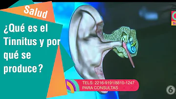 ¿Cuáles son las tres causas del tinnitus?