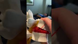Back Pain Surgery Alternative