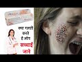 skin shine cream | Side effects | Benefits | how to use | यही सच्चाई किसी ने नहीं बतायी होंगी