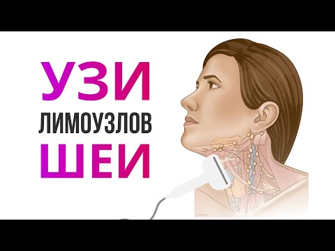 УЗИ щитовидной железы и лимфоузлов шеи. 7 уровней лимфоузлов шеи.  Лимфоузлы в норме и патологии.