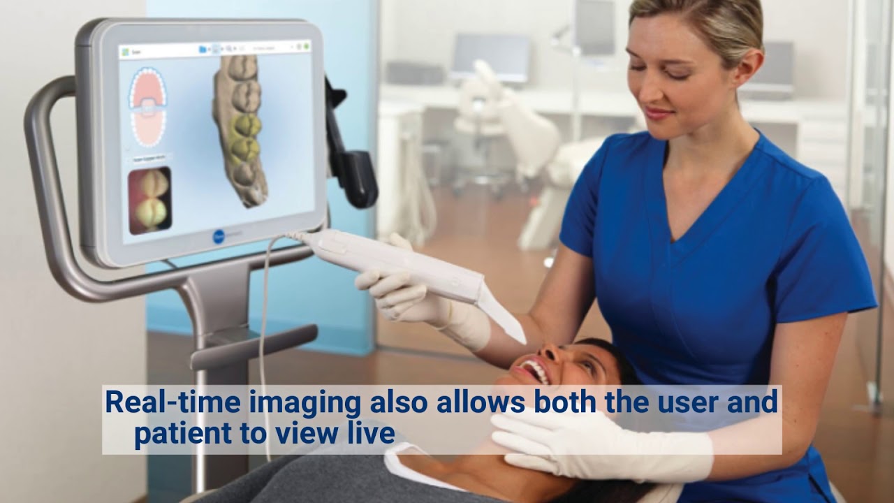 Cornerstone Dental Lab Now Accepting iTero Digital Files YouTube