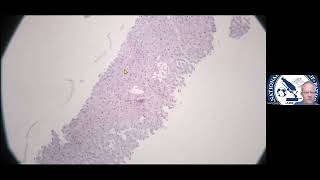 Pathology Case Presentations - Prof Martin Hale & Dr Bilal Bobat