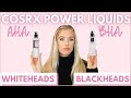 COSRX Power Liquids Comparison: AHA Whitehead vs. BHA Blackhead