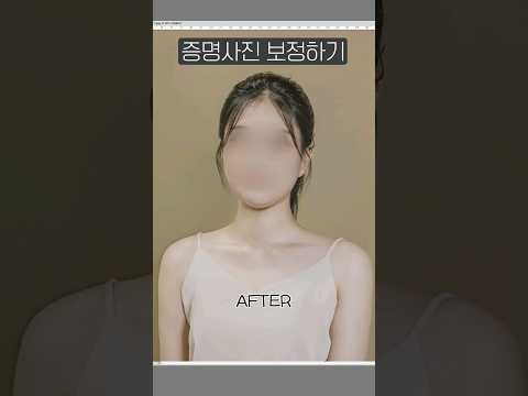 승모근만 보정하면 안되는 이유 #shorts