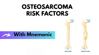 Osteosarcoma Risk Factor Mnemonic | Surgery Mnemonics | Medicine Mnemonics | Mubashar Ata screenshot 4