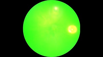 Laser CNV procedure in a C57Bl/6 mouse.