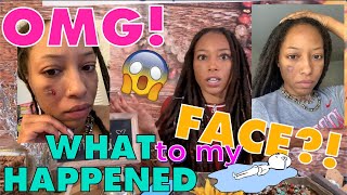 WHAT HAPPENED TO MY FACE?! + MENTAL HEALTH CHECKIN &amp; ORDER UPDATES🌻✨