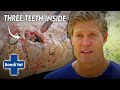 Vet Removes 3 TEETH That Got Trapped In Crocs Mouth | Bondi Vet