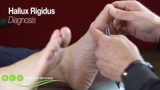 shoes for hallux rigidus 218