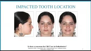 CBCT   A Third Eye in Orthodontics Part 1