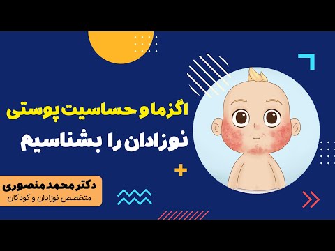 تصویری: 4 راه درمان طبیعی اگزما در نوزادان