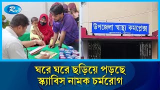 কুমিল্লার মুরাদনগরে দিন দিন বাড়ছে  স্ক্যাবিস নামক চর্মরোগে আক্রান্ত রোগীর সংখ্যা |  Muradnagar | Rtv