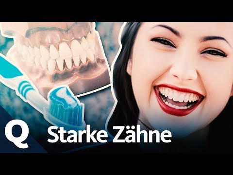 Video: Sind überzählige Zähne selten?