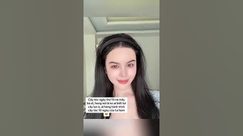 UPDATE  NGÀY THỨ 30 SAU KHI CẤY TÓC SỢI DÀI KHÔNG CẠO ĐẦU SẼ NHƯ THẾ NÀO ?  #caytoc #hairtranplant