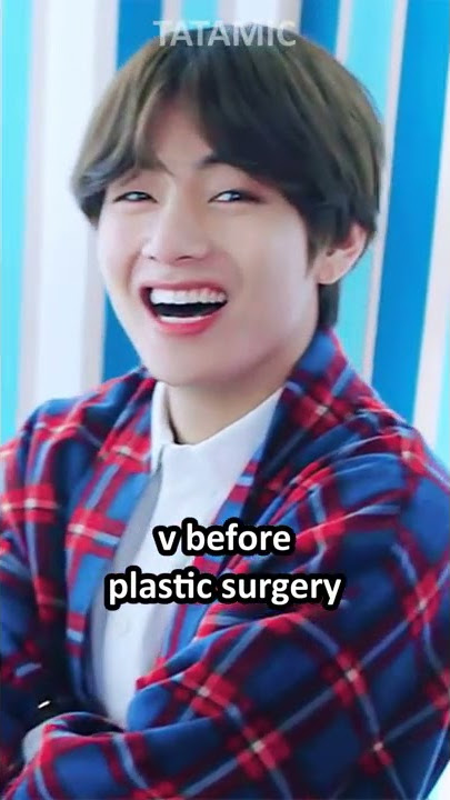 BTS BEFORE/AFTER PLASTIC SURGERY