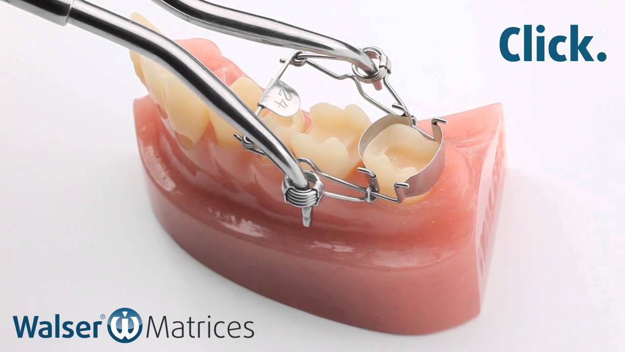 Walser® Sectional Matrix system Application ONform dental matrix