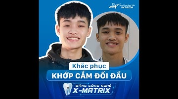 KHẮC PHỤC KHỚP CẮN ĐỐI ĐẦU BẰNG CÔNG NGHỆ NIỀNG RĂNG X-MATRIX