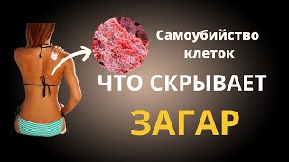 Что скрывает ЗАГАР? Полезно ли загорать?