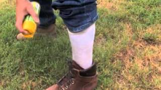Ticks and Chiggers Differences Between Seed Ticks And Chiggers