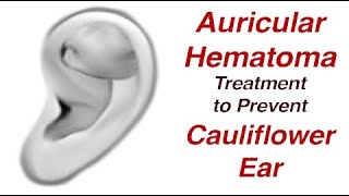 Auricular Hematoma Treatment to Prevent Cauliflower Ear