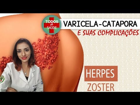 Vídeo: Complicações Da Catapora Em Adultos