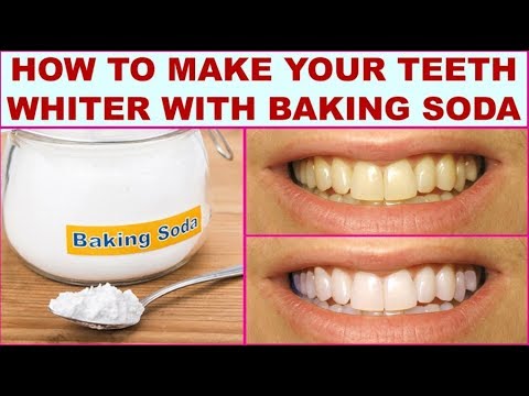 How To Whiten Teeth With Braces With Baking Soda Teethwalls