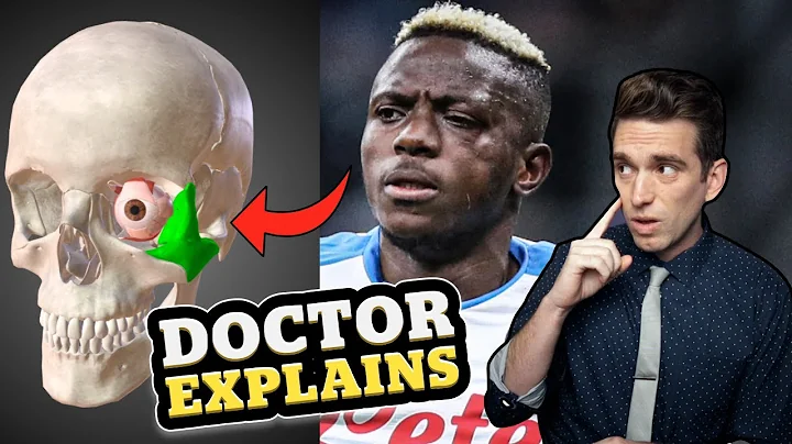 *UPDATE* Victor Osimhen MAJOR Facial Trauma Injury Explained by Doctor