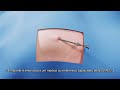 IMPLANTES HOMONAIS SILÁSTICOS NÃO ABSORVIVEIS IMPLANTES HOMONAIS SILÁSTICOS NÃO ABSORVIVEIS