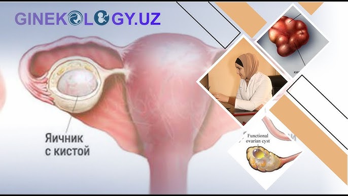 Yosh rus qizlari jinsiy porno