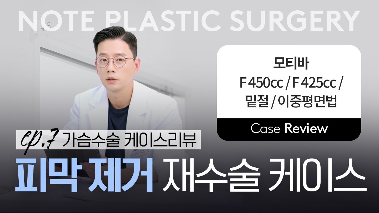 [가슴리뷰] 구형구축 l 윗볼록 l 가슴 재수술 l 모티바