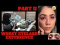 Worst Eyelash Experience PART II