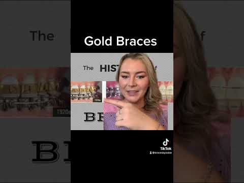 Gold braces! Would you get these #shorts #braces #orthodontist #invisalign